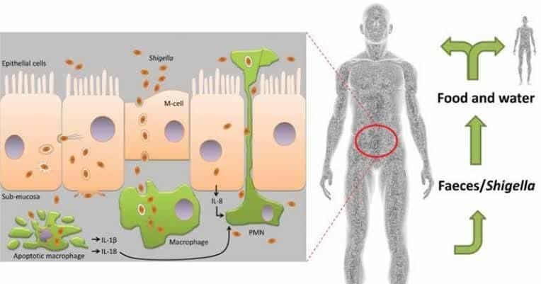 Various old and new treatments for Shigella Infection