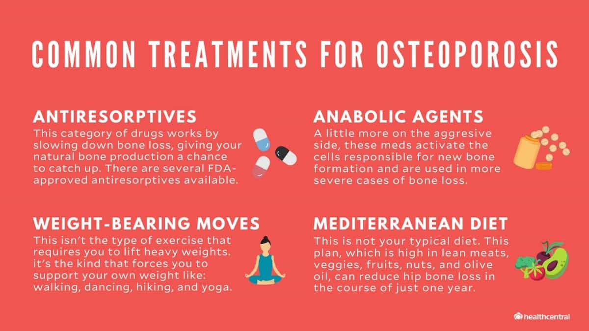 Various Treatment Options for Osteoporosis