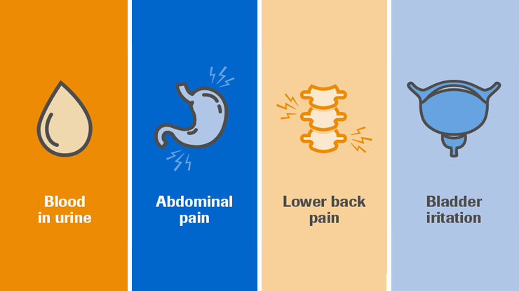 Various Symptoms Of Bladder Cancer and How to Recognize It