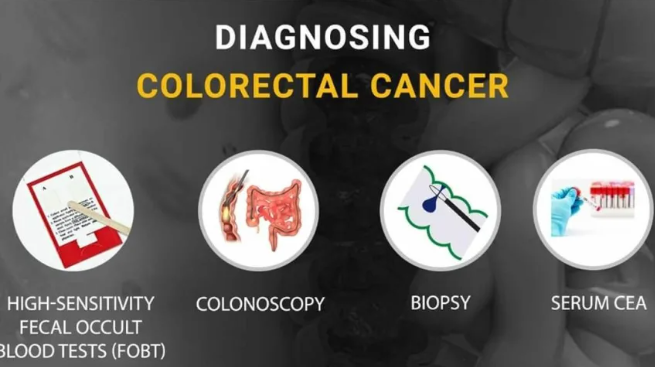 Various Symptoms of Colorectal Cancer and How to Recognize It