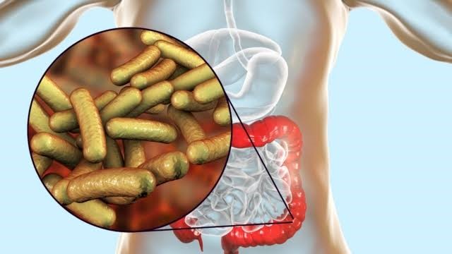 Shigella Infection (Shigellosis)